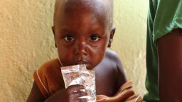 A malnourished child on March 21 at a hospital in Bukina Faso.