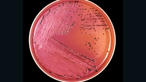 Salmonella bacteria, shown here in a petri dish, can cause fever, abdominal cramps and diarrhea.