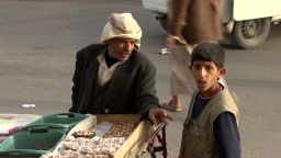 pkg elwazer yemen food crisis_00014209