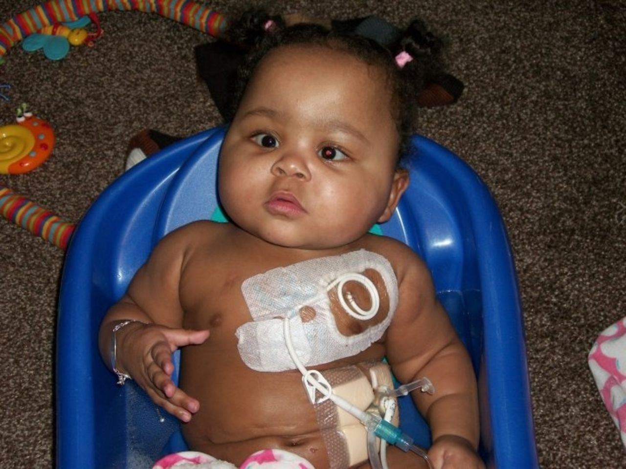 Alicia Coleman had a feeding tube in her stomach and a chest tube in her vein. A caregiver at a medical daycare mistakenly used the wrong tube and pumped medicine into Coleman's chest instead of her stomach. Coleman died when the medicine stopped her tiny heart.