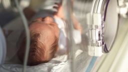 The U.S.'s preterm birth rate is the highest among industrialized countries, according to the March of Dimes.