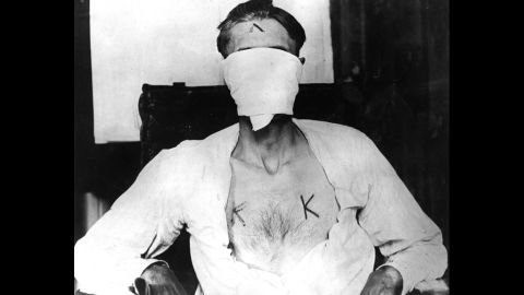 Nelson Burroughs was kidnapped by members of the Ku Klux Klan and branded with hot irons in 1924 because he refused to renounce his Catholic vows.