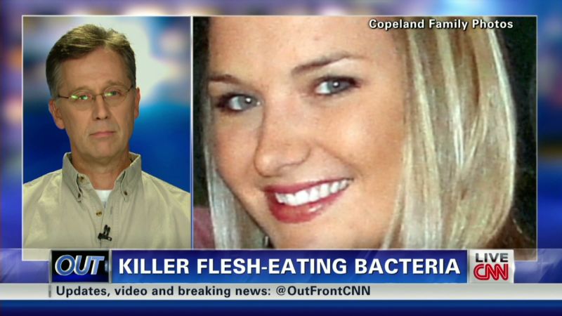 Georgia Woman With Flesh-eating Infection Dramatically Improves | CNN