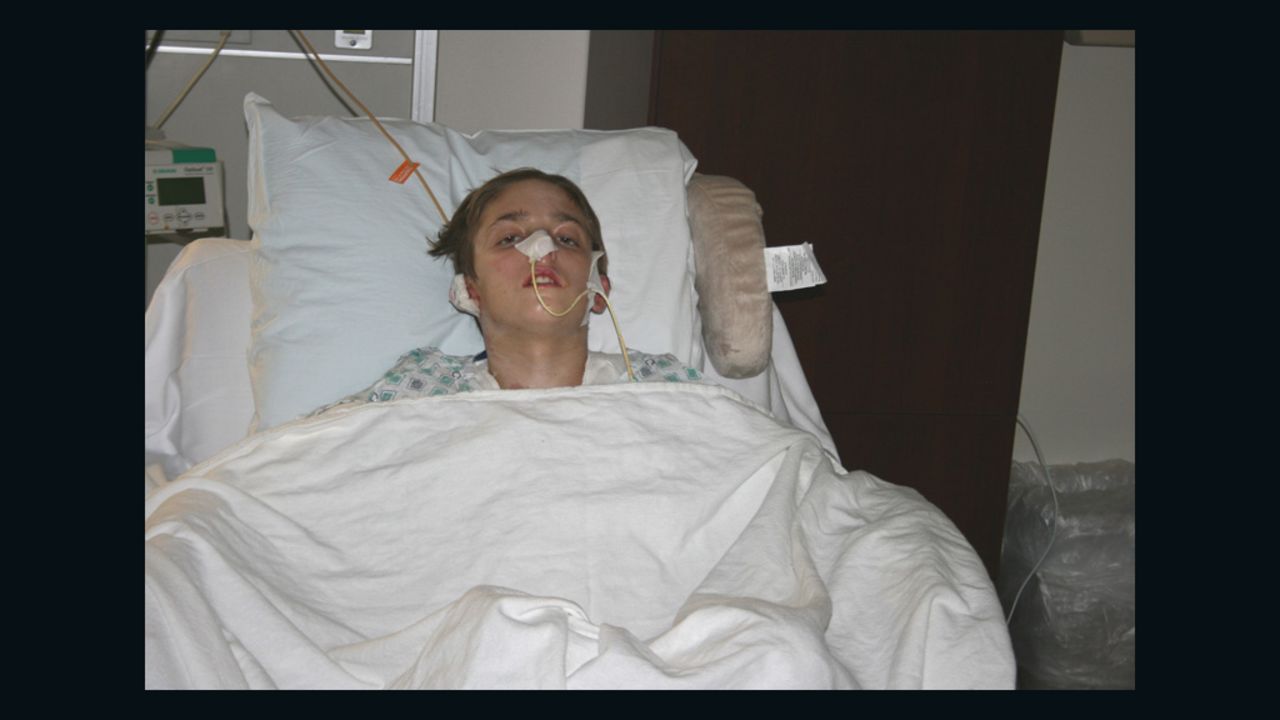 Michael Brewer spent two months in the hospital in 2009 when three teens set him on fire in a dispute over $40.