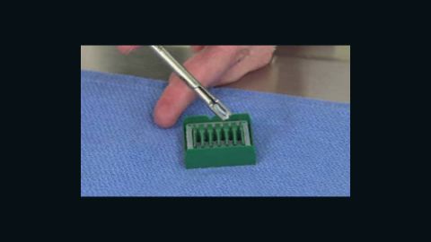 A warning letter tells surgeons not to use a specific arterial clip on kidney donors, but many haven't seen the letter.