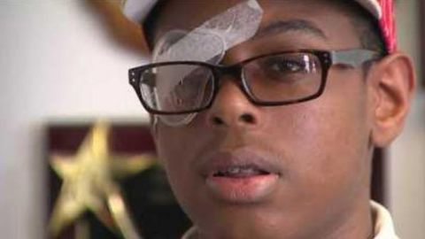 Kardin Ulysse, 14, is suing the New York school system, saying it failed to supervise the youths who beat him.