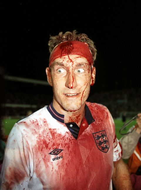 This iconic image of bloodied former England defender Terry Butcher taken in 1989 during a World Cup qualifier embodies the "warrior" style in which the country has always played. It is an approach based on bravery, endeavour and hard work but it has not  brought any success since the 1966 World Cup -- England's only major tournament victory.