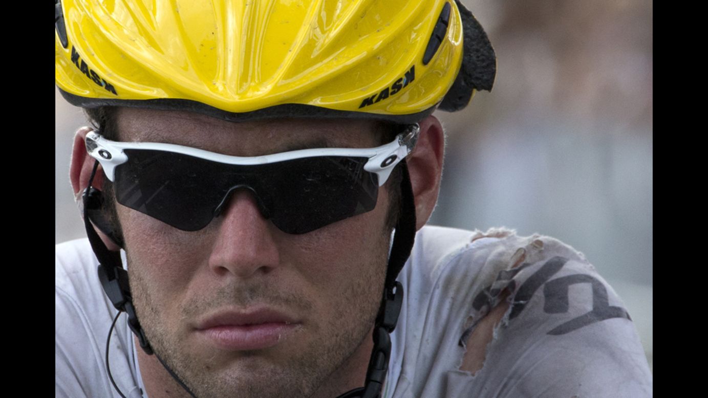 Cavendish rolls to the finish with visible injuries and damage to his jersey and helmet after crashing near the finish.