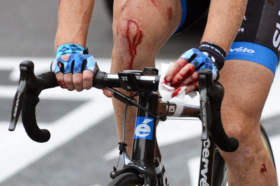 Farrar bleeds from multiple wounds as he rolls through to the finish line after crashing in the final sprint Thursday.