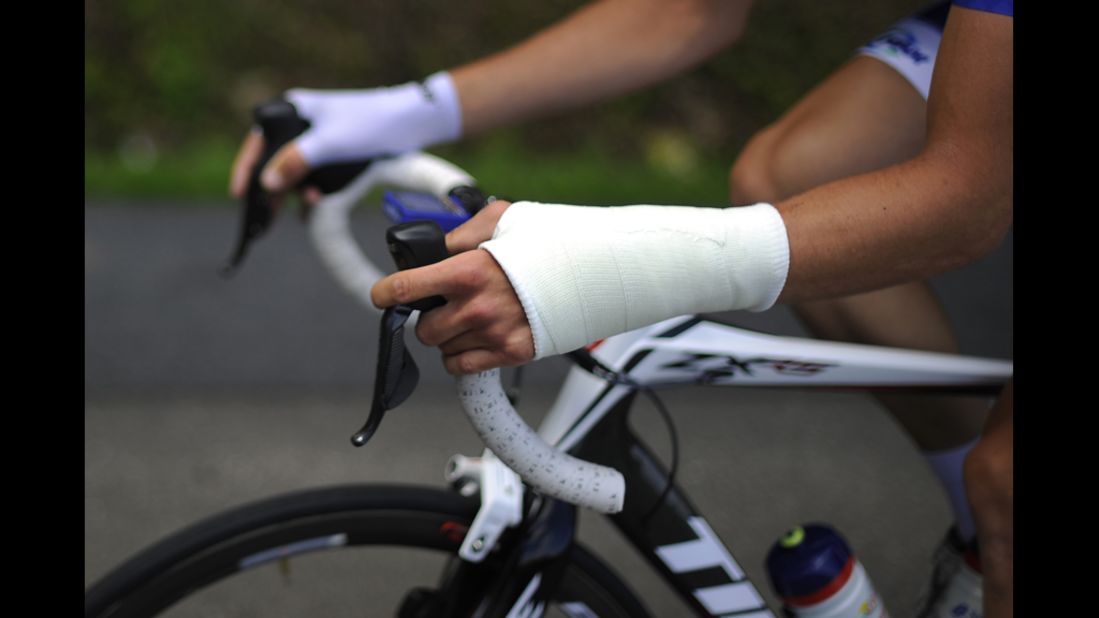 Anthony Delaplace of France, who has an injured wrist, retired from the race Saturday.