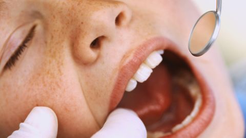 13 scary Halloween health hazards | CNN