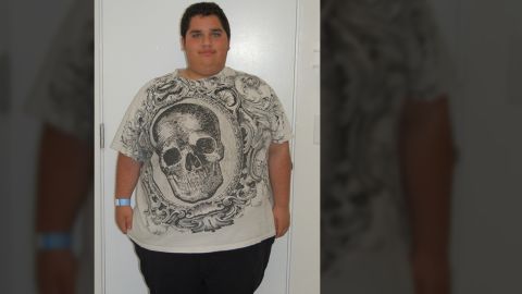 Before the surgery, Matt Cianciullo weighed 333 pounds and was on medication to lower his cholesterol. 