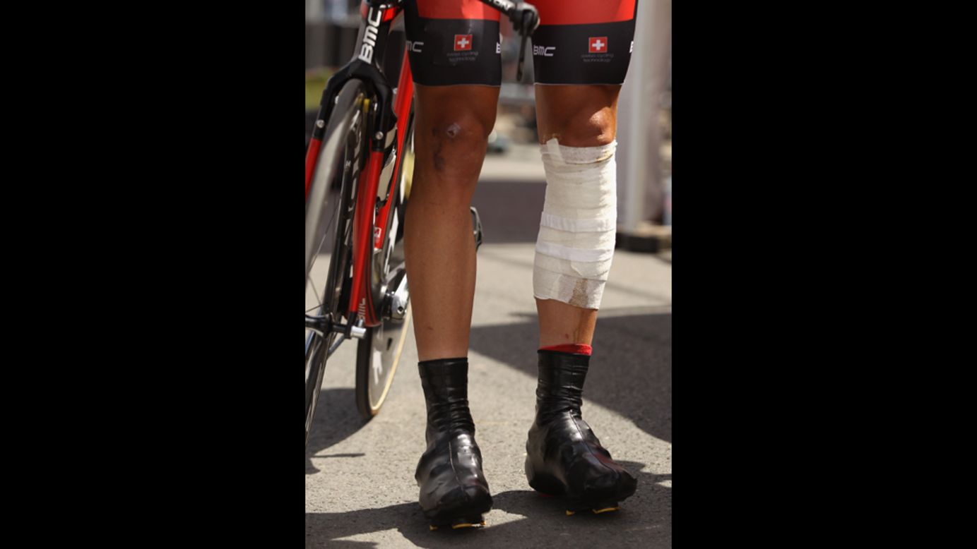 British rider Stephen Cummings wears bandages on his legs. 