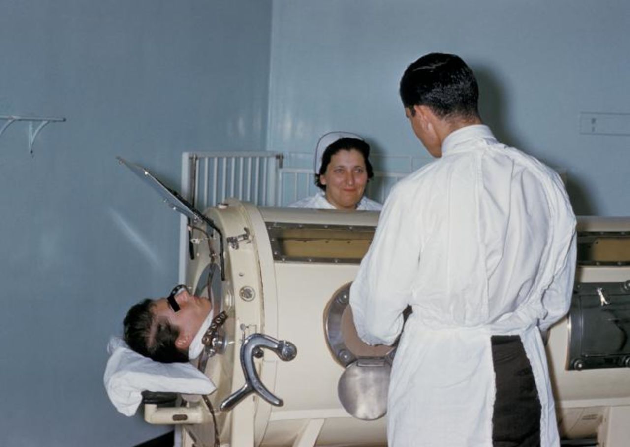 Polio patients who could not breathe on their own were put into this respirator device, called an "iron lung." This image is from 1960.