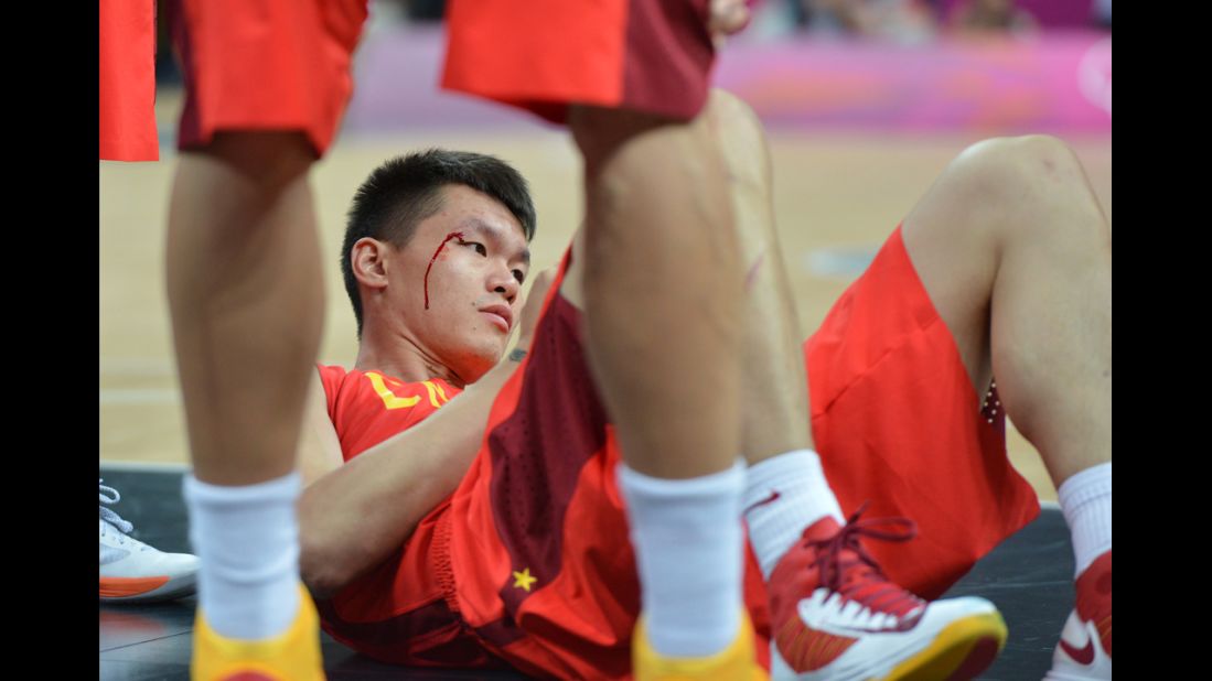 Chinese forward Zhu Fangyu bleeds during a men's preliminary round basketball match between China and Australia.