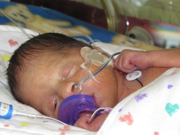 Shortly after his birth, Patrick had a section of his intestines temporarily diverted into a colostomy bag. 