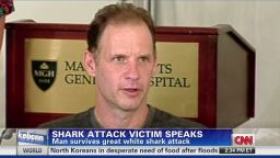 nr survivor speaks about shark attack_00002801