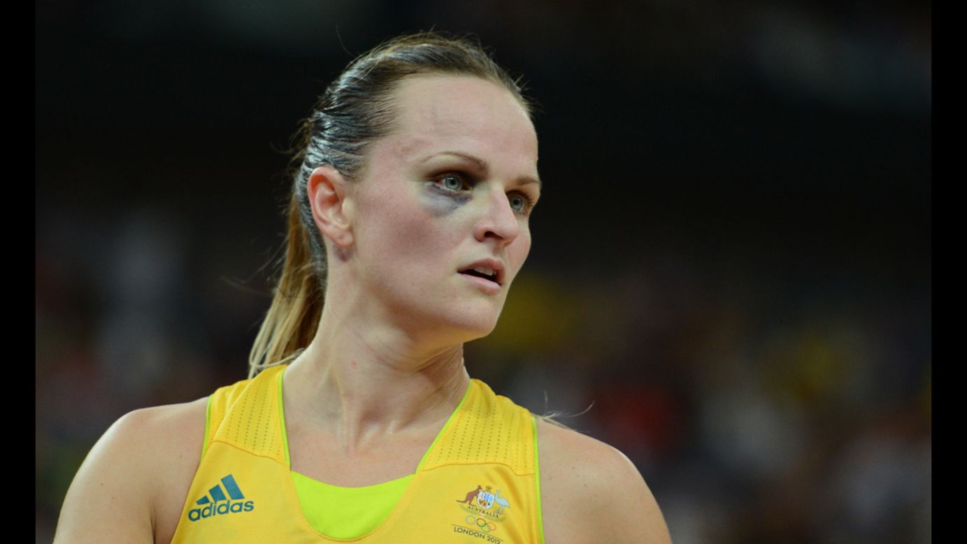 Australian guard Jennifer Screen competes in the women's bronze medal basketball game between Australia and Russia.