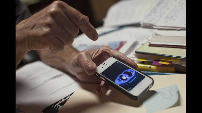 Joe Redner shows a picture of a tumor on his cell phone at his office. Redner was diagnosed with lung cancer in 2011 but, after several chemotherapy sessions, he is believed to be in remission. <br />