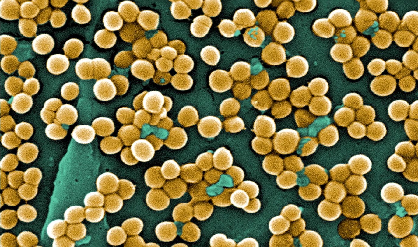 mrsa bacteria