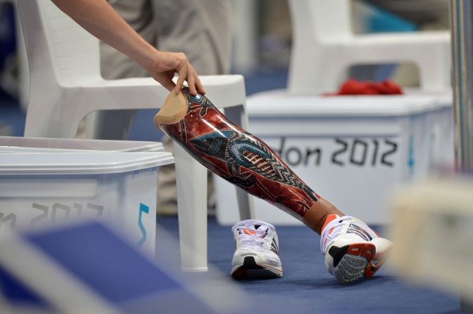 A volunteer moves the prosthetic leg of Sven Decaesstecker of Belgium during the men's SM10 200-meter individual medley swimming heat.