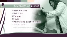 Living with lupus _00004822