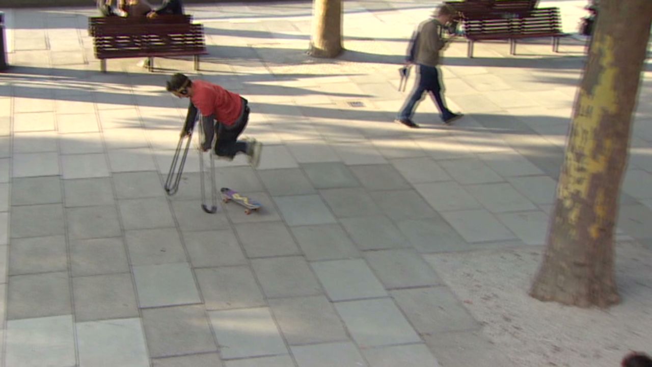Dancer Bill Shannon shows CNN how to dance with crutches CNN