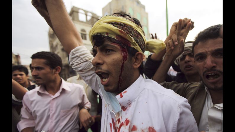 A protester shouts after sustaining injuries in a confrontation with riot police who fired tear gas outside the U.S. Embassy in Sanaa on Thursday.