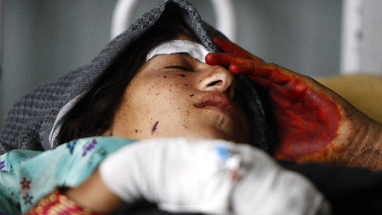 A wounded woman gets treatment at a hospital after the air strikes on Sunday, September 16.