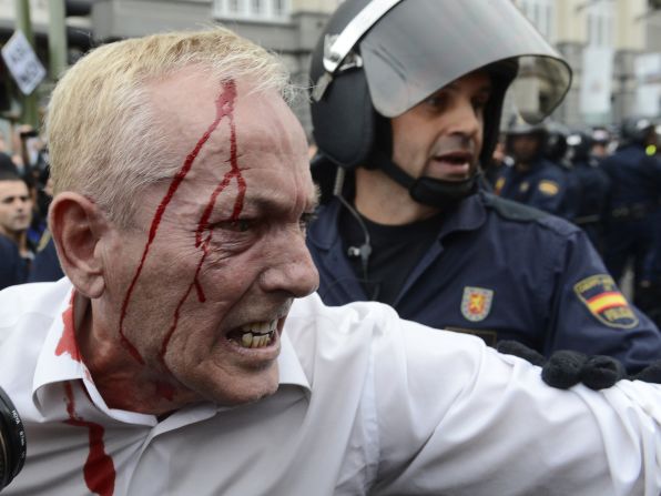 A riot police officer stands behind an injured protester after clashes. Demonstrators said police shot into the crowd with rubber bullets; police wouldn't comment.