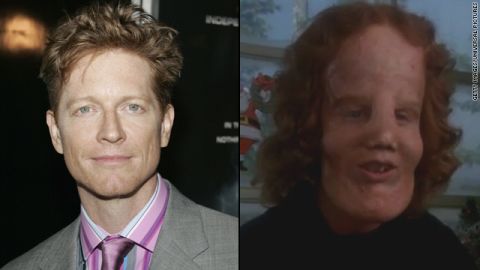 The makeover for Eric Stoltz in 1985's "Mask" was astounding as Stoltz portrayed Rocky Dennis, a boy trying to live a normal life with the disorder lionitis. The transformation picked up an Oscar for best makeup.