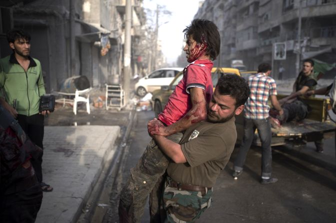 A fighter injured in the Arqub neighborhood of northern city of Aleppo is brought to a hospital on October 1, 2012, as fighting in Syria's second largest city between rebel forces and government troops continues. 