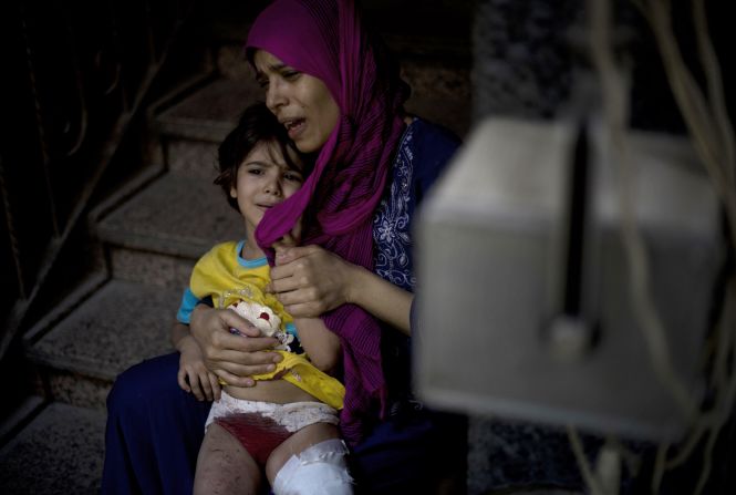 A mother holds her wounded daughter as she waits for treatment at the Dar al-Shifa hospital in the northern city of Aleppo, as fighting in Syria's second largest city continues.