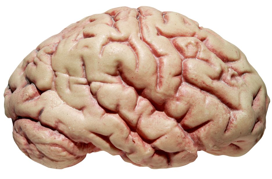 "A sheep brain we were dissecting in neuroanatomy class." —Rana Lee Adawi Awdish