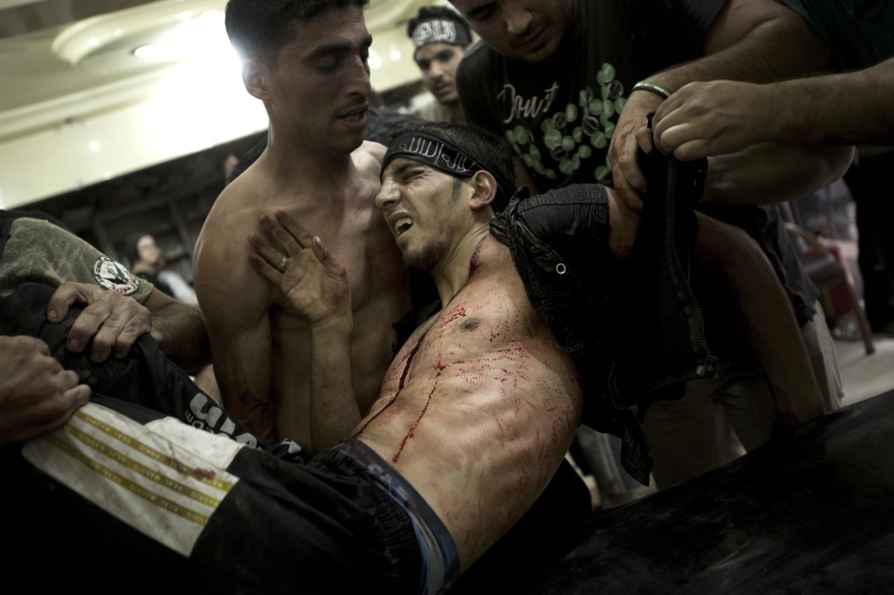 A rebel fighter is carried by his friends and laid on a gurney to be treated for gunshot wounds sustained during heavy battles with government forces in Aleppo on October 1, 2012.