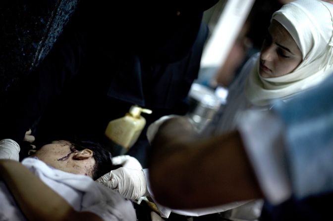 A nurse helps treat a 7-year-old girl who's neck was badly wounded by shrapnel at the Dar Al Shifaa hospital in Aleppo on Monday, October 1.