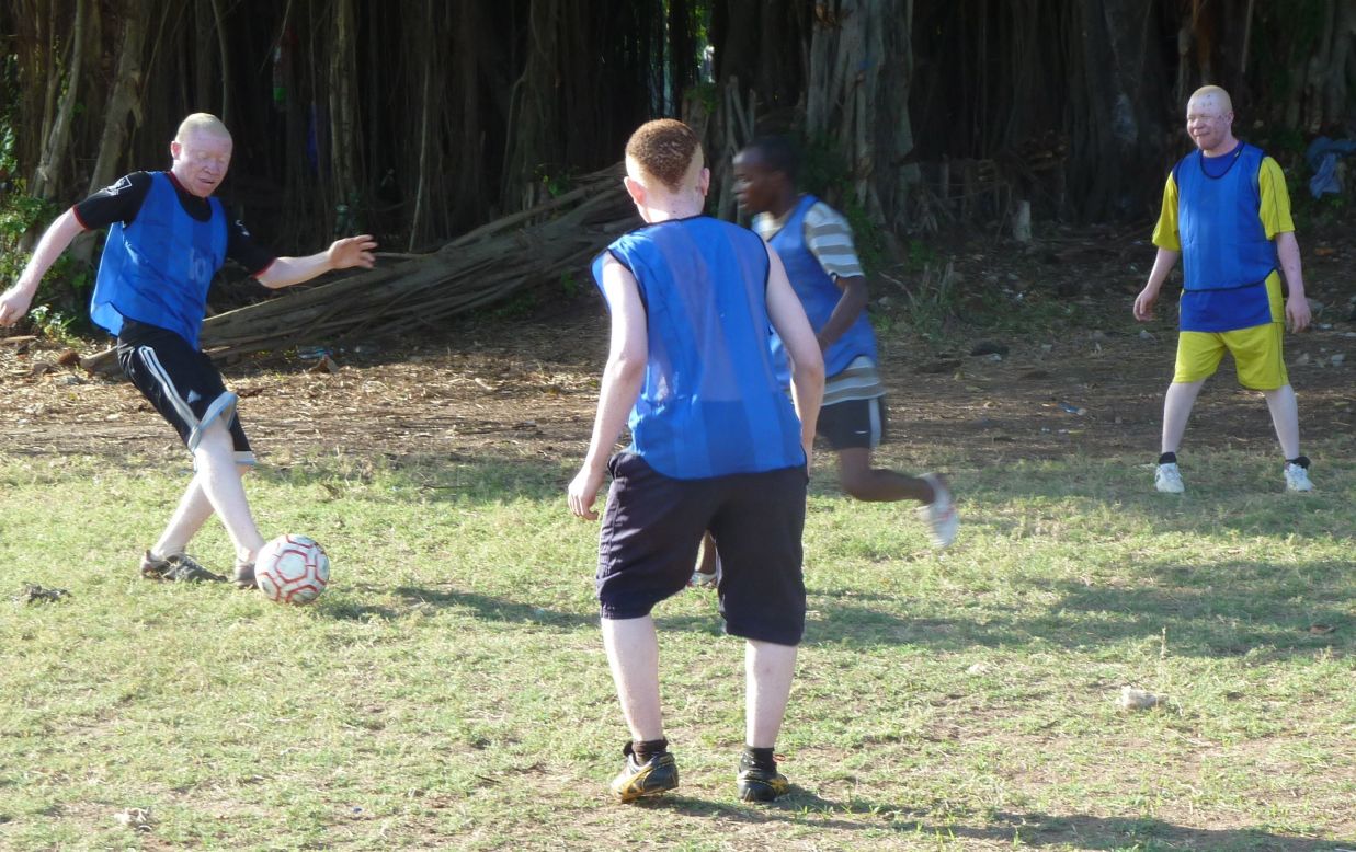 Musa has found support through an informal football team made up of people with albinism.  Albino United hope to dispel myths about people with the genetic disorder.