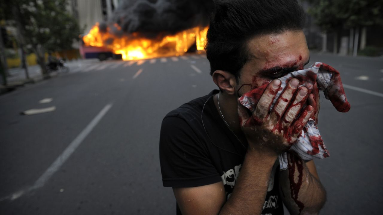 An injured protester covers his face during riots in Tehran in 2009. Iran's disputed election triggered mass opposition protests.
