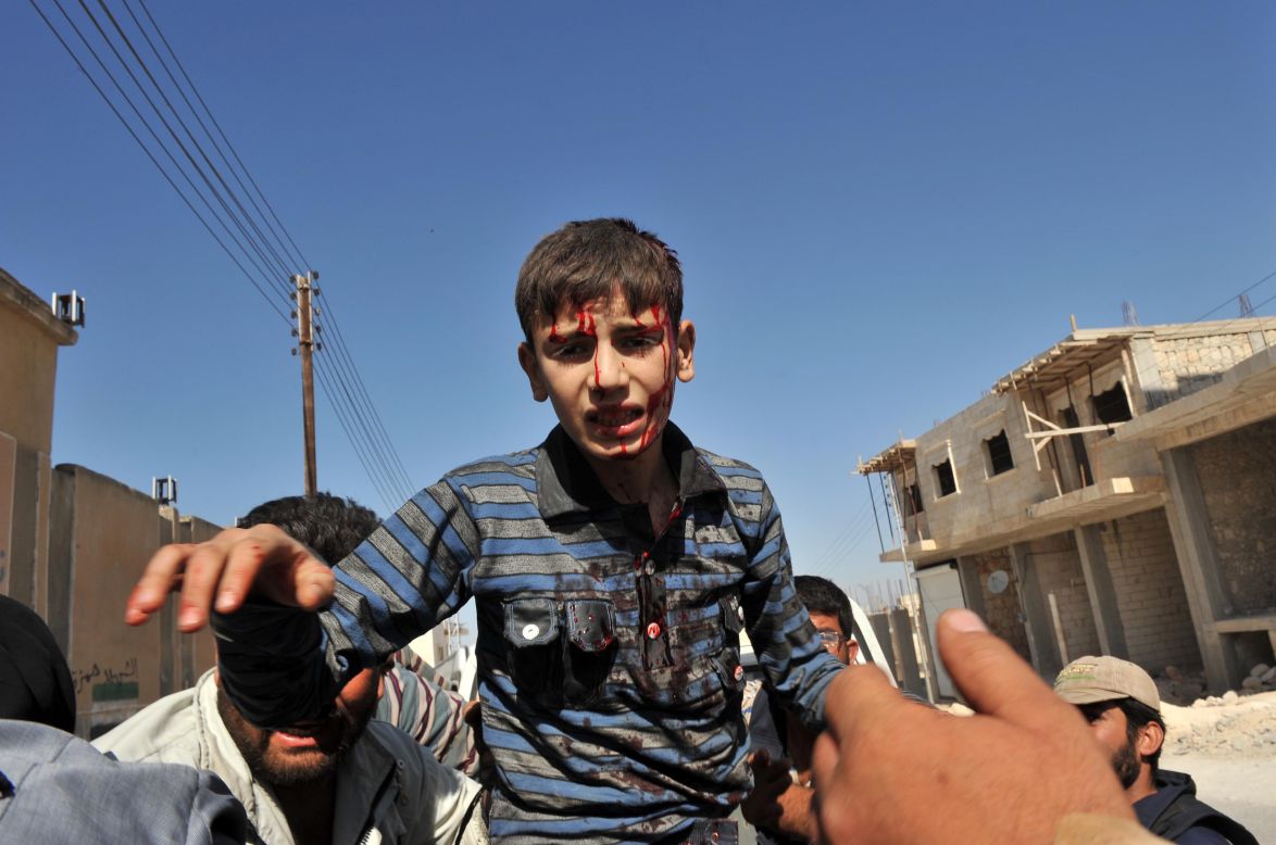 A wounded Syrian boy is carried to the hospital following Thursday's airstrike in Maaret al-Numaan.