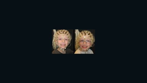 Twins Jacob and Lucas Campbell hooked up to EEGs.