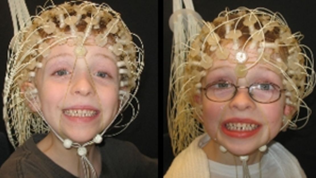 Twins Jacob and Lucas Campbell hooked up to EEGs.