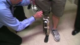 dnt first bionic leg _00002624