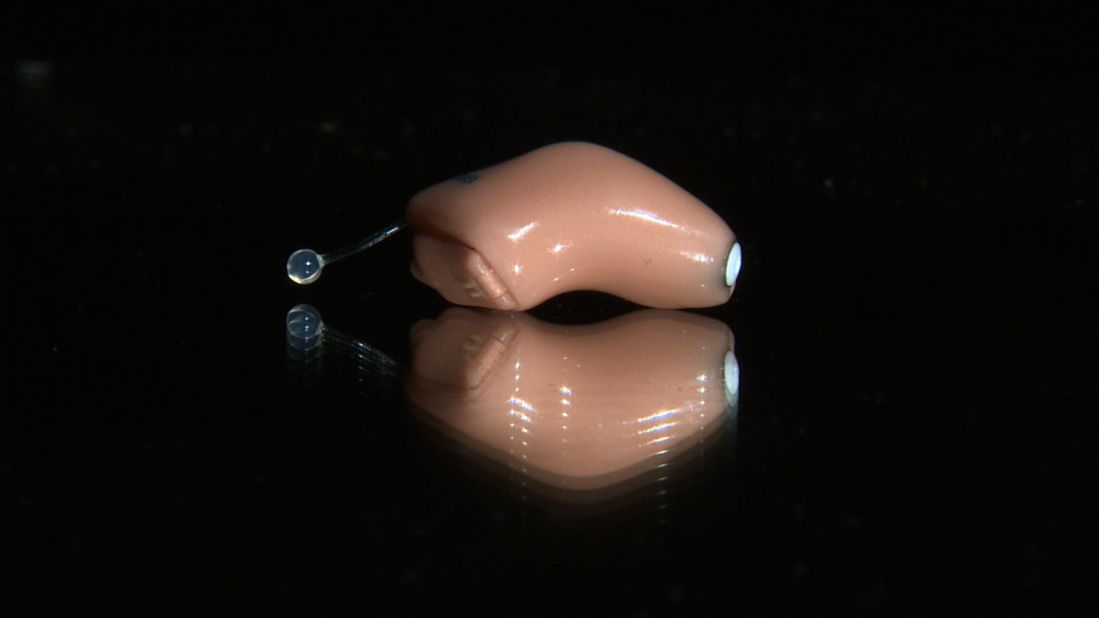 Danish technology company Widex has pioneered a discreet digital hearing aid which matches the exact dimensions of a wearer's ear canal. The patented technology is called CAMISHA (Computer Aided Manufacturing of Individual Shells for Hearing Aids.)