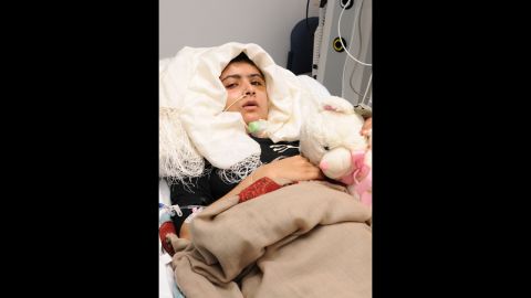 Malala recovers after receiving treatment at Queen Elizabeth Hospital in Birmingham on October 19, 2012. Doctors covered the large hole in her skull with a titanium plate. The teen suffered no major brain or nerve damage, and she even kept the piece of her skull that was removed as a souvenir of her fight. 