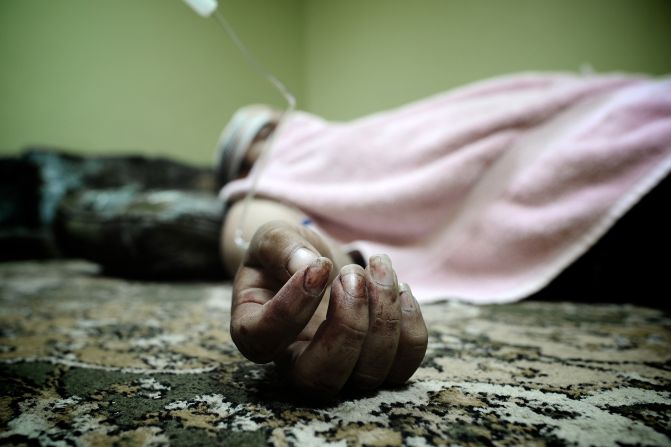 A Bahraini Shiite man lies in his house after being wounded in the clashes.