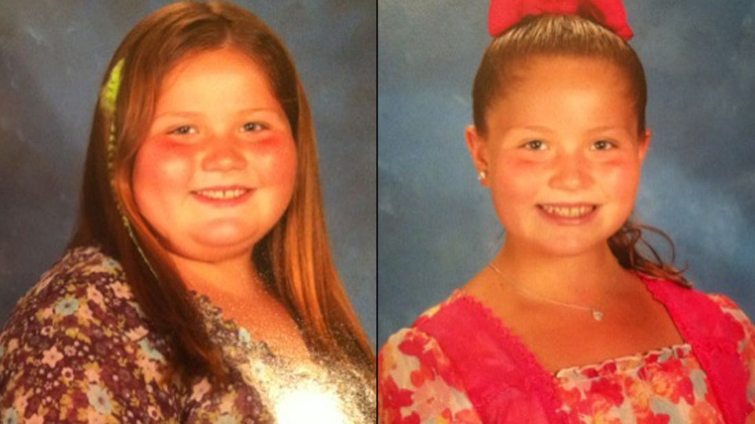 Breanna Bond weighed 186 pounds when she was just 9. In under a year, she dropped 65 pounds. 