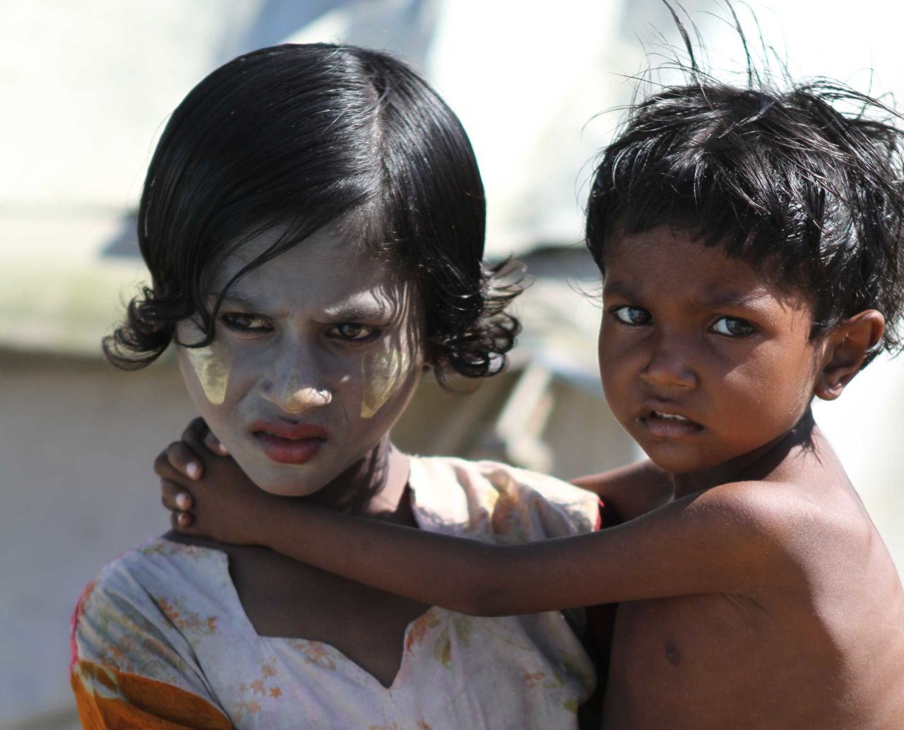 A girl wearing "thanaka" on her face carries her brother. The traditional cosmetic made form tree bark is used as sunscreen, insect repellent and antiseptic. After nearly half a year in the camps doctors are afraid more an more children are at risk of acute malnutrition.
