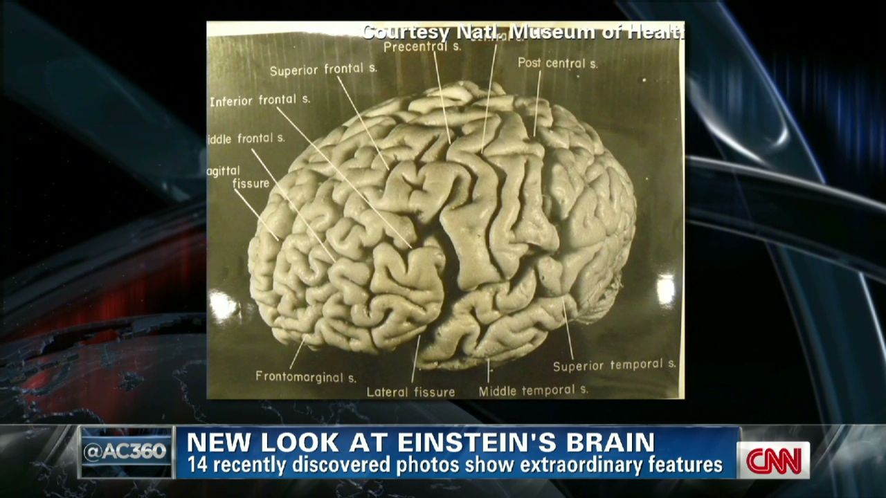einstein brain vs normal brain
