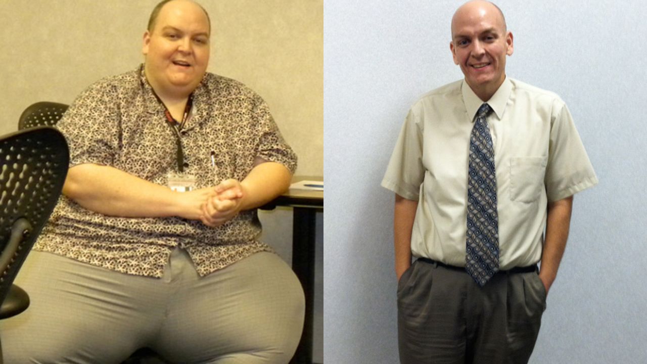 For years, Bryan Ganey worked the night shift, bingeing on fast food and soda for breakfast, lunch and dinner. By the age of 37, he had a body mass index of 87 (anything over 30 is considered obese). Then, a pulmonary embolism changed his life. In 2½ years, he's lost 347 pounds. 