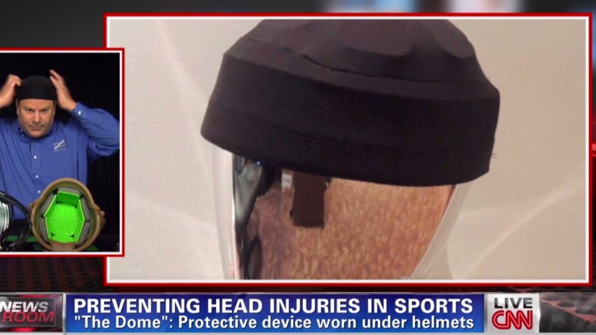 nr sports helmets protect brain injuries_00001830